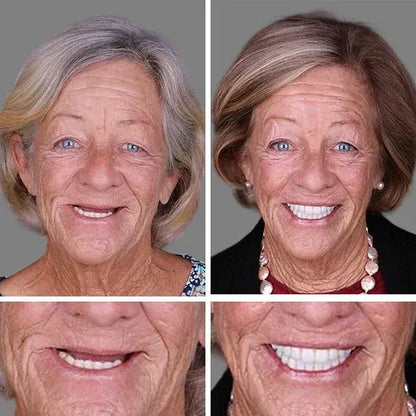 ⏰ Ends Today: 50% OFF!  KLENIMORE™ Daily Smile Confidence Set — Natural Look, Easy Everyday Wear
